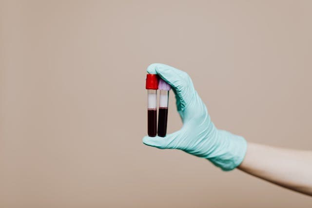 Pruebas de Laboratorio